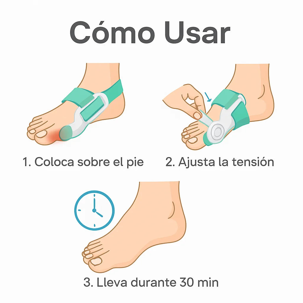 Corrector de Juanetes FlexToe | Alivia y recupera tus hermosos pies en semanas