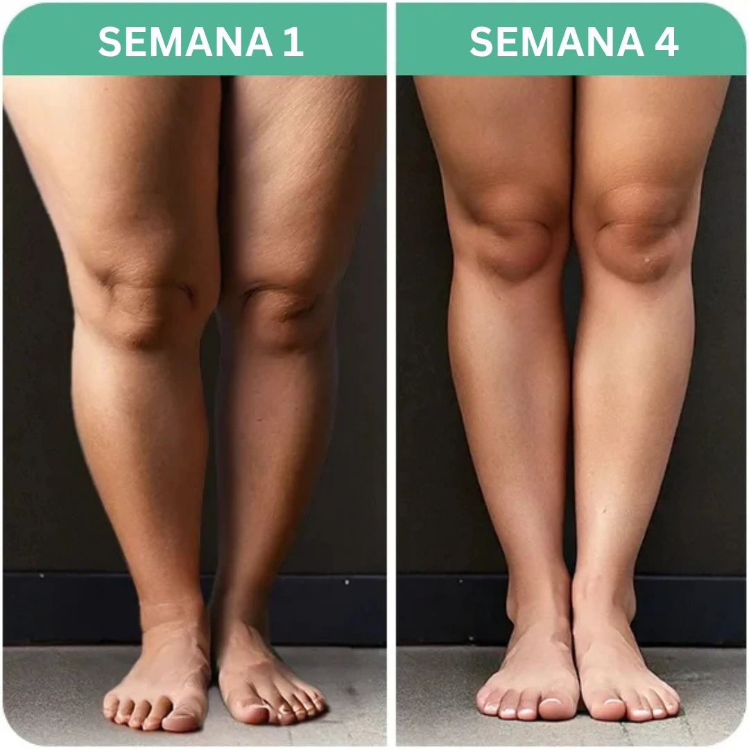 Revitalizador Térmico LinfoTech | Rejuvenece tus piernas HOY