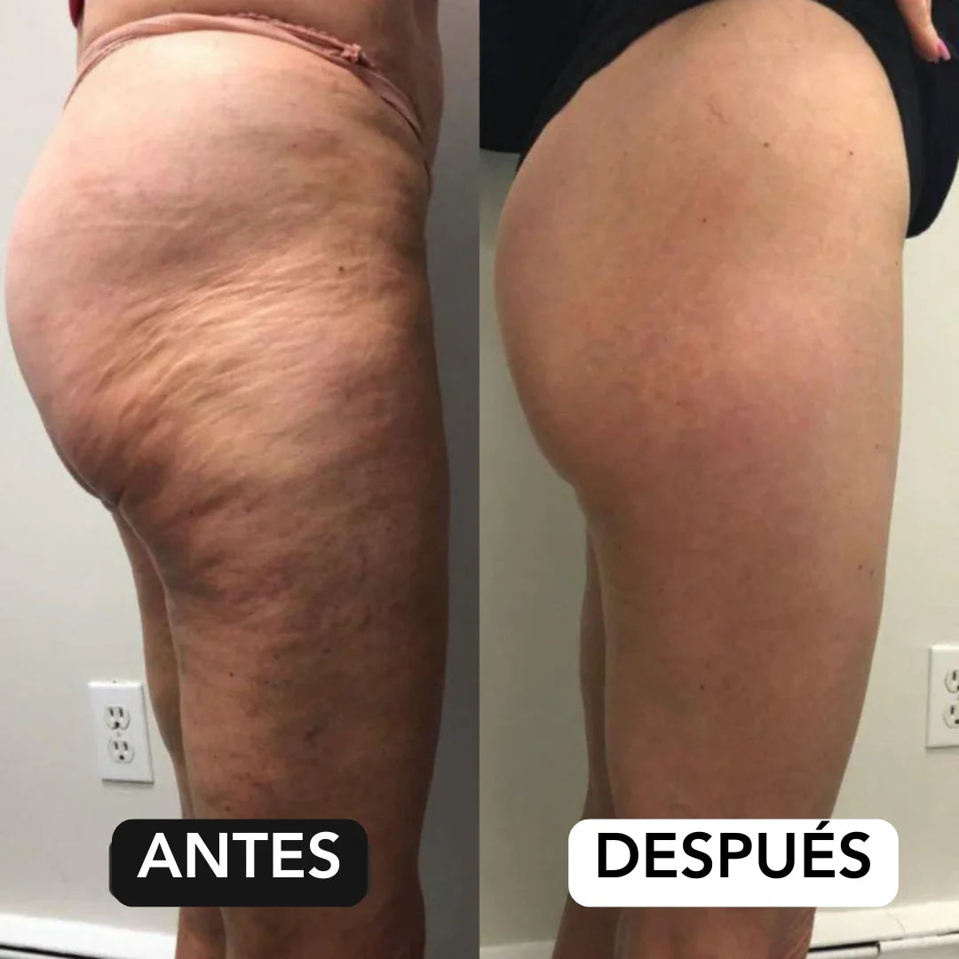 SkinGlow | Tonifica profesionalmente desde casa