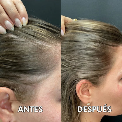 Seed Oil | Ataca la caída del cabello desde la raíz y recupera tu melena en semanas